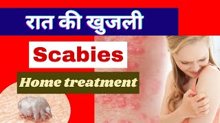 खुजलीखाज  Scabies   scabies home treatment in hindi  khujali ki dawa  itching [upl. by Gerlac]