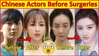 Chinese Actors Before and After Plastic Surgeries 😮  Incredible Changes Chinese Drama [upl. by Notnats]