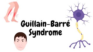 Understanding GuillainBarre Syndrome [upl. by Ahsia]