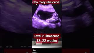 Types of Scan for pregnancy Types of ultrasound for pregnancy viralshort anatomy babypregnant [upl. by Fiedling]