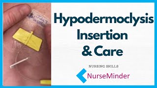 Hypodermoclysis Insertion and Care for Nurses [upl. by Eednac]