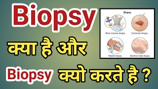 बायोप्सी क्या होती है  बायोप्सी क्यों करते हैं  biopsy kya hoti hai biopsy kya hai  BIOPSY [upl. by Roxine]