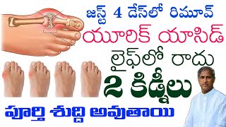 Uric Acid  జస్ట్ 4 డేస్ లో రిమూవ్ యూరిక్ యాసిడ్ లైఫ్ లో రాదు  Dr Manthena Satyanarayana Raju [upl. by Adigirb1]