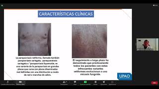 DERMATO 4 PARAPSORIASIS EN GRANDES PLACAS [upl. by Lear]