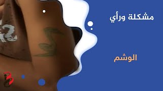 مشكلة ورأي  الوشم [upl. by Ddart157]