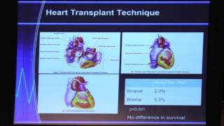 Organ Transplantation in ACHD  Dr Reshma Biniwale  2017 UCLA ACHD Symposium [upl. by Boniface]