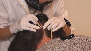 ASMR Examining Skin LESIONS on SCALP  Inspection with Sticks Real Person [upl. by Eiznekam628]