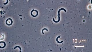 Spirilla bacteria seen through a compound microscope [upl. by Notsur]