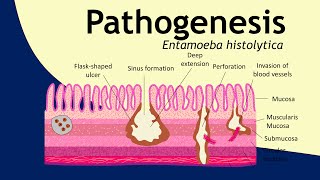 Pathogenesis of Entamoeba histolytica  parasitology  Basic Science Series [upl. by Nahtanohj]