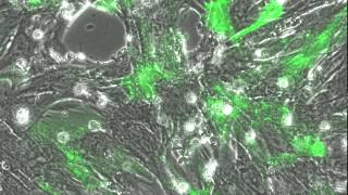 beating cardiomyocytes with green fluorescence [upl. by Elleira]