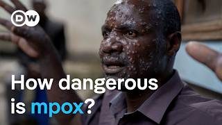 New mpox virus Why is it spreading so quickly  DW News [upl. by Dorkus]