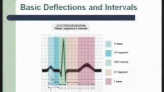 Interpretation of ECG [upl. by Lael417]
