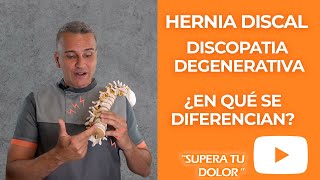 ¿En qué se diferencian la Hernia Discal y la Discopatía degenerativa Te lo contamos en este vídeo [upl. by Artinad]