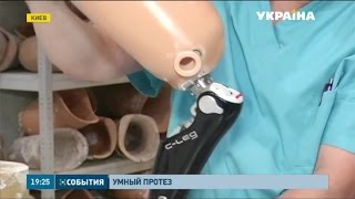 В Украине создают «умные» многофункциональные протезы [upl. by Tdnaltroc]