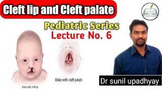 CLEFT LIP AND CLEFT PALATE  Pediatric series lecture number 6  by Dr SUNIL SIR [upl. by Tegdirb]