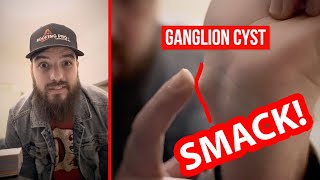 Ganglion Cyst Smash Bible Bump [upl. by Ytsur]