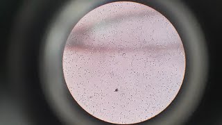 Semen Analysis Test  Microscopic Examination of Semen Test  Semen Test Procedure [upl. by Alohs36]