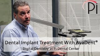 AvaDent® Digital Dental Implants and Treatment [upl. by Newton]