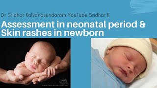 Assessment of newborn including antenatal concerns and examination Neonatal skin rash Dr Sridhar K [upl. by Dickie]