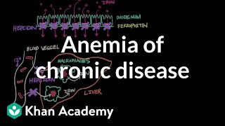 Anemia of chronic disease  Hematologic System Diseases  NCLEXRN  Khan Academy [upl. by Niram182]