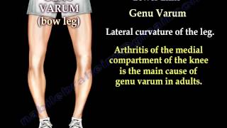 Alignment Of The Lower Limb  Everything You Need To Know  Dr Nabil Ebraheim [upl. by Dosh]