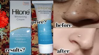 hitone whitening cream  best medicated cream for skin brightening amp freckles  pigmentation [upl. by Anaoy]