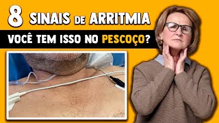 8 Sintomas da arritmia cardíaca │ Médico Explica [upl. by Takashi]