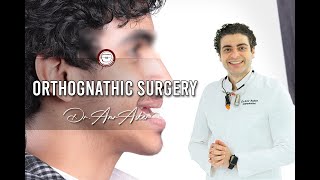 Orthognathic Surgery [upl. by Niwdla762]