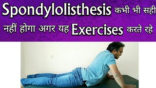 Spondylolisthesis Exercises  Exercises To AVOID For Spondylolisthesis TREATMENT [upl. by Hedy]