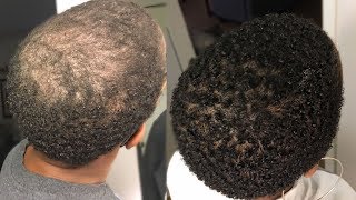 My 100 Natural HAIR GROWTH Serum  2 Month Update  GrowWithMe  Nia Hope [upl. by Roe31]