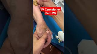 IV Cannulation  Part 592  ICU shorts youtubeshorts ivcannulation viralvideo medical hospital [upl. by Noicnecsa355]