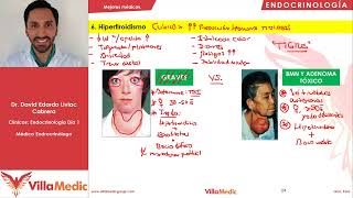 Hipertiroidismo  Endocrinología  Villamedic Clínicas 2021 [upl. by Repotsirhc348]