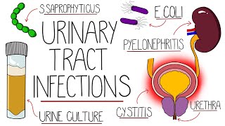 UTI Made Easy  Urinary Tract Infections Explained Clearly [upl. by Nerwal]