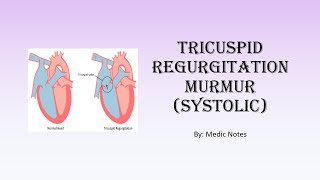 Tricuspid regurgitation murmur  description causes pathophysiology [upl. by Jacobba362]