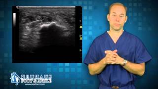 How Ultrasound is used to treat Plantar Fasciitis Heel Pain [upl. by Oriaj]