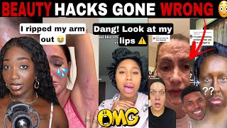 MERCY😱 BEAUTY HACKS GONE WRONG COSMETIC TRAUMA DIY BEAUTY FAILS  TIK TOK COMP [upl. by Norrv659]