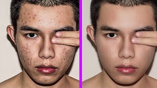 Fastest way to clean your face in photoshop  Remove pimples blemishes acne easily [upl. by Yllop454]