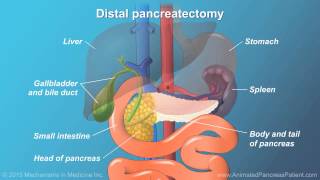 Pancreatic Surgery Benefits Risks and Relevant Anatomy [upl. by Javed781]