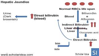 Hepatic jaundice الصفراء الكبدية [upl. by O'Doneven]