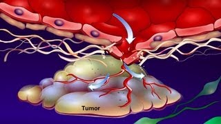 Introduction to Cancer Biology Part 4 Angiogenesis [upl. by Lem]