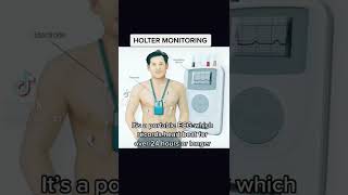 Holter monitoring [upl. by Luise]