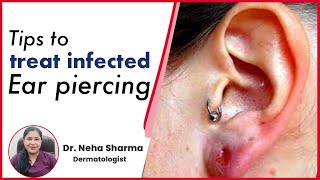 How to treat infected Ear Piercing  Timesxp [upl. by Akinad]