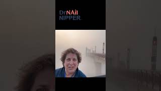 Dr Nail Nipper in St Paul along the Mississippi River drnailnipper foothealth footcare [upl. by Dyl]