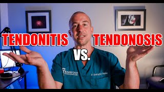 Hamstring Tendonitis vs Tendonosis What You NEED To Know [upl. by Allys]