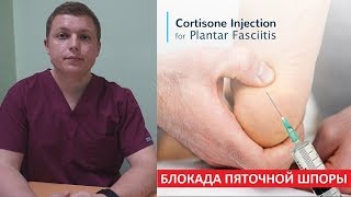 Блокада пяточной шпоры  Plantar Fasciitis Injection Treatment [upl. by Anelleh]