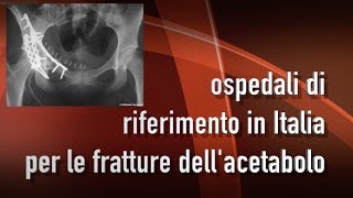 Dott Raffaele Pascarella Direttore Ortopedia e Traumatologia Ospedale Riuniti di Ancona [upl. by Sosanna76]