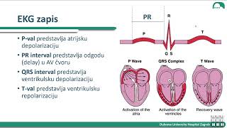 EKG i aritmije ZVU 1 dio [upl. by Aeiram585]