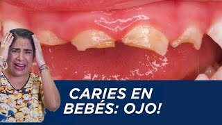 Caries en bebés ¡ojo [upl. by Oberg]