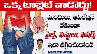 How to Get Relief from Piles Without Operation  Hemorrhoids Symptoms  Dr Ravikanth Kongara [upl. by Monk]