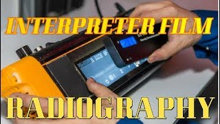 How to Interpretation Radiography Film for Beginer [upl. by Arjun253]